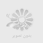 هزينه ارتودنسي متحرك در مشهد